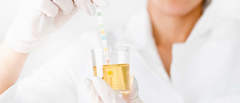 pH urine test